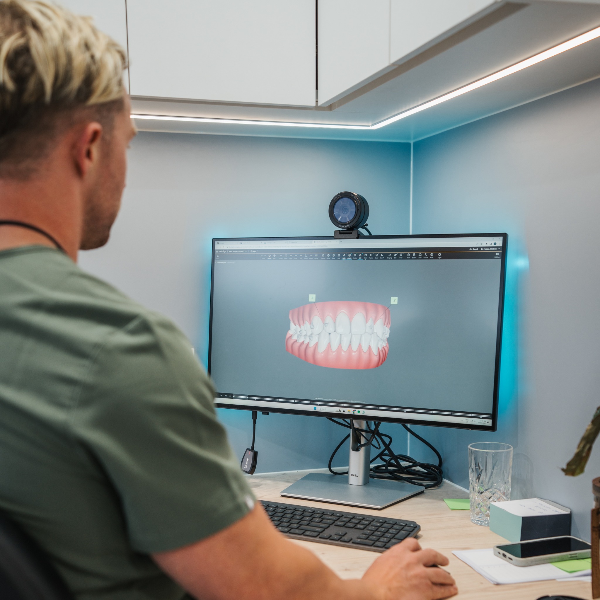 Composite Bonding at Helix Dental
