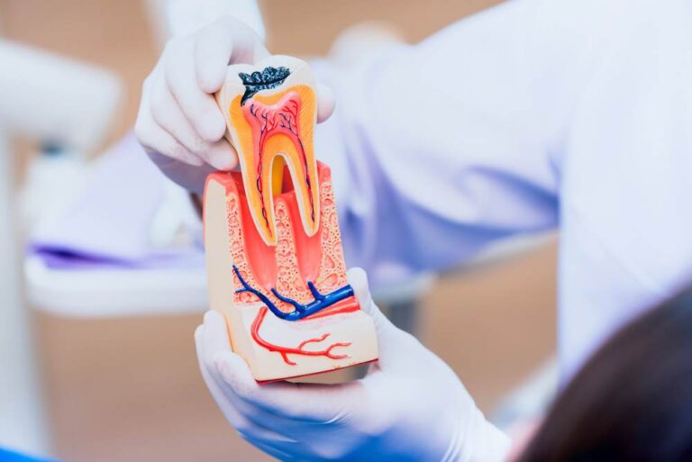 The Benefits Of Root Canal Treatment A Comprehensive Guide